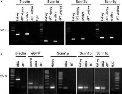 ENaC in Cholinergic Brush Cells